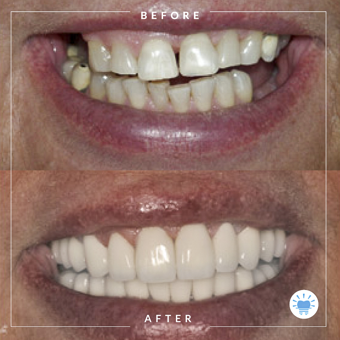 before-after-westmountdentist5-Edit